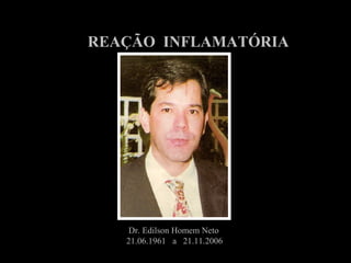 REAÇÃO INFLAMATÓRIA
Dr. Edilson Homem Neto
21.06.1961 a 21.11.2006
 