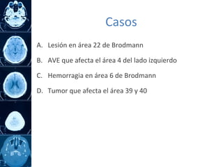 A. Lesión en área 22 de Brodmann
B. AVE que afecta el área 4 del lado izquierdo
C. Hemorragia en área 6 de Brodmann
D. Tumor que afecta el área 39 y 40
Casos
 