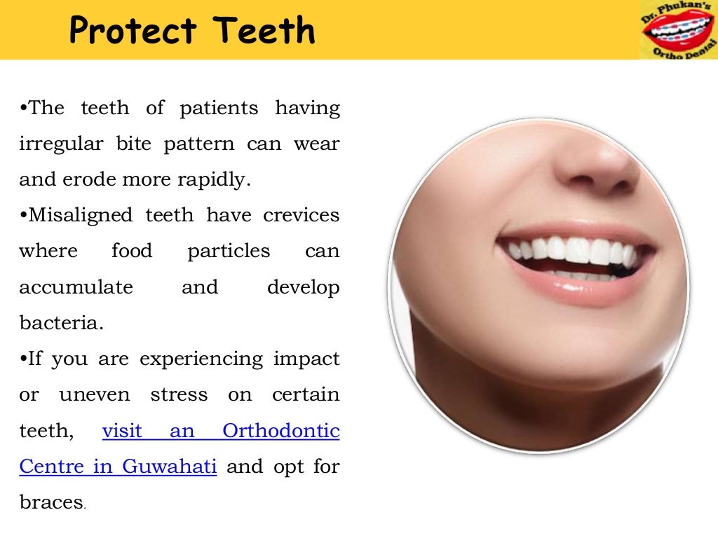 5 Reasons to Approach a Orthodontic Centre in Guwahati for Braces