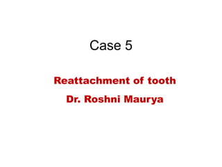Case 5
Reattachment of tooth
Dr. Roshni Maurya
 