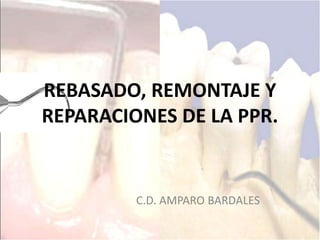 REBASADO, REMONTAJE Y
REPARACIONES DE LA PPR.
C.D. AMPARO BARDALES
 