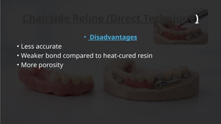 Comprehensive Guide to Denture Relining and Rebasing Techniques | PPTX