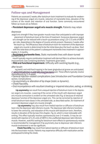 103
Chapter 9 Marionette Lines
Follow-ups and Management
Complications and Management
Patients are assessed 2 weeks after botulinum toxin treatment to evaluate for weaken-
ing of the depressor anguli oris muscle, reduction of marionette lines, elevation of the
corners of the mouth and retention of oral function. Some commonly encountered
follow-up issues are as follows:
• Persistent depressor anguli oris muscle strength. Patients may retain
depressor
anguli oris strength if they have greater muscle mass than anticipated or with improper
placement of botulinum toxin at the time of treatment. Excessive depressor anguli
oris strength can be reduced with a touch-up procedure using 1.25–2.5 units of OBTX
per side, depending on the degree of muscle activity present. Reassess 2 weeks after
the touch-up. The efficacious dose of botulinum toxin for treatment of the depressor
anguli oris muscle is determined to be the initial dose plus the touch-up dose. Start
with this total dose at the patient’s subsequent marionette lines treatment in approxi-
mately 2–3 months.
• Persistent marionette lines. Static marionette lines with down-turned
corners of the
mouth typically require combination treatment with dermal fillers to achieve dramatic
improvements (see Combining Aesthetic Treatments given later).
• Mild oral functional impairment. Difficulty with swishing liquids (e.g.,
after brush-
ing teeth) and mild food trapping in the lower gingivobuccal groove are anticipated,
which indicate that an adequate dose has been used. These effects typically resolve
spontaneously by 2–4 weeks.
• General injection-related complications (see Introduction and Foundation Concepts
section, Complications).
• Lip asymmetry or alteration of lip shape (static or dynamic).
• Cheek flaccidity.
• Oral incompetence with resultant drooling or impaired elocution, eating, or drinking.
Lip asymmetry can result from unequal injection of botulinum toxin in the depres-
sor anguli oris muscles. Lowering of the corner of the mouth with depressor anguli
oris muscle contraction is evident on the untreated side (Fig. 6) because of retained
depressor function of the depressor anguli oris. This can be corrected by injection of
small botulinum toxin doses in the untreated side, as described earlier, for treatment of
persistent depressor anguli oris muscle strength.
Lip asymmetry may also result from medial injection or diffusion of botulinum
toxin into the depressor labii inferioris muscle. The depressor labii inferioris functions
to lower the central lip, and relaxation of this muscle with botulinum toxin, therefore,
results in elevation of the lip (see Chin chapter, Fig. 6), which is most noticeable with
smiling. This effect typically resolves spontaneously over 2–4 weeks. It may be cor-
rected with injection of 1.25 units of OBTX in the unaffected depressor labii inferioris
muscle. However, watchful waiting for botulinum toxin effects to spontaneously resolve
is recommended for management if lip asymmetry due to depressor labii inferioris
muscle involvement is not too significant.
Cheek flaccidity may result from lateral injection or diffusion of botulinum toxin
into the buccinator muscle. Patients may experience difficulty with mastication and be
predisposed to biting the cheek.
 