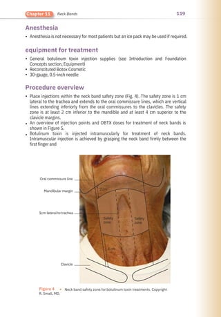 119
Chapter 11 Neck Bands
Anesthesia
Procedure overview
equipment for treatment
•
•
•
•
•
•
•
Anesthesia is not necessary for most patients but an ice pack may be used if required.
General botulinum toxin injection supplies (see Introduction and Foundation
Concepts section, Equipment)
Reconstituted Botox Cosmetic
30-gauge, 0.5-inch needle
Place injections within the neck band safety zone (Fig. 4). The safety zone is 1 cm
lateral to the trachea and extends to the oral commissure lines, which are vertical
lines extending inferiorly from the oral commissures to the clavicles. The safety
zone is at least 2 cm inferior to the mandible and at least 4 cm superior to the
clavicle margins.
An overview of injection points and OBTX doses for treatment of neck bands is
shown in Figure 5.
Botulinum toxin is injected intramuscularly for treatment of neck bands.
Intramuscular injection is achieved by grasping the neck band firmly between the
first finger and
Oral commissure line
Clavicle
Mandibular margin
1cm lateral to trachea
2 cm
4 cm
Safety
zone
Safety
zone
Figure 4 ●
R. Small, MD.
Neck band safety zone for botulinum toxin treatments. Copyright
 