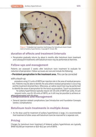 131
Chapter 12 Axillary Hyperhidrosis
Pricing
Follow-ups and management
Complications and management
duration of effects and treatment Intervals
Botulinum toxin treatments in multiple Areas
•
•
•
Charges for botulinum toxin treatment of bilateral axillary hyperhidrosis are typically
$900–$1200 per treatment or $10–$12 per unit of OBTX.
General injection-related complications (see Introduction and Foundation Concepts
section, Complications)
As the dose used for treatment of axillary hyperhidrosis is large, it is recommended
that treatment of other areas with botulinum toxin be reserved for a separate visit.
Perspiration gradually returns by about 6 months after botulinum toxin treatment
and subsequent treatments with botulinum toxin may be performed at that time.
Patients are assessed 2 weeks after botulinum toxin treatment to evaluate for
reduction of perspiration. Follow-up issues are rare and include the following:
• Persistent perspiration in the treatment area. This can be corrected
with a touch-up
procedure using 2.5 units of OBTX per injection site in the area of residual perspira-
tion. Patients may be able to identify the area where residual perspiration is occurring
and the treatment directed there. Otherwise, an iodine-starch test may be performed
to identify the areas of perspiration for the touch-up procedure. Touch-up procedures
for axillary hyperhidrosis typically require 10–20 units of OBTX per axilla. At sub-
sequent visits, use 45–50 units of OBTX, as it still may be possible to achieve an
adequate response with this dose.
●
Figure 7 Intradermal injection technique for botulinum toxin treat-
ment of axillary hyperhidrosis. Copyright R. Small, MD.
 