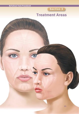 Section 3
Treatment Areas
23
BoTulinum Toxin ProcedureS
 