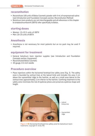37
Chapter 2 Horizontal Forehead Lines
Anesthesia
reconstitution
starting doses
Procedure overview
equipment for treatment
•
•
•
•
•
•
•
•
•
Women: 15–22.5 units of OBTX
Men: 20–25 units of OBTX
Anesthesia is not necessary for most patients but an ice pack may be used if
required.
Reconstitute 100 units of Botox Cosmetic powder with 4 mL of nonpreserved saline
(see Introduction and Foundation Concepts section, Reconstitution Method)
Botulinum toxin products are not interchangeable and all references in this chapter
to onabotulinumtoxinA (OBTX) refer specifically to Botox.
Place injections within the horizontal forehead line safety zone (Fig. 3). The safety
zone is bounded by vertical lines at the lateral limbi and includes the area 2 cm
above the supraorbital ridge to the hairline, as well as a small area lateral to the
vertical lines approximately 2 cm inferior to the hairline. Confining treatment to the
safety zone minimizes the risk of eyebrow ptosis and preserves eyebrow shape and
height.
General botulinum toxin injection supplies (see Introduction and Foundation
Concepts section, Equipment)
Reconstituted Botox Cosmetic
30-gauge, 0.5-inch needle
Figure 3 ●Horizontal forehead line safety zone for botulinum toxin
treatments. Copyright R. Small, MD.
Safety zone
2 cm
Lateral
limbus line
Supraorbital
ridge
 