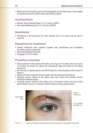 68 Botulinum toxin Procedures
•
•
•
•
•
•
•
•
•
•
•
•
Women: total (bilateral) dose is 5–7.5 units of OBTX.
Men: total (bilateral) dose is 7.5–10 units of OBTX.
Anesthesia is not necessary for most patients but an ice pack may be used if
required.
Botulinum toxin products are not interchangeable and all references in this chapter
to onabotulinumtoxinA (OBTX) refer specifically to Botox.
Place injections in the eyebrow lift safety zone (Fig. 4). The safety zone is at least 1
cm outside the orbital rim, below the supraorbital ridge and lateral to the lateral
limbus line.
An overview of injection points and OBTX doses for a lateral eyebrow lift is shown in
Figure 5.
Botulinum toxin is injected intramuscularly with the eyebrow lift procedure.
Injecting superior lateral to the safety zone may involve the frontalis muscle,
resulting in eyebrow ptosis.
Injecting superior medial to the safety zone at the lateral limbus line may involve
eyelid levator muscles, resulting in blepharoptosis (droopy upper eyelid).
General botulinum toxin injection supplies (see Introduction and Foundation
Concepts section, Equipment)
Reconstituted Botox Cosmetic
30-gauge, 0.5-inch needle
Anesthesia
starting doses
Procedure overview
Equipment for treatment
Supraorbital
ridge
Safety
zone
Lateral
limbus line
1 cm outside
of orbital rim
Figure 4 ● Eyebrow lift safety zone for botulinum toxin treatments. Copyright R. Small, MD.
 