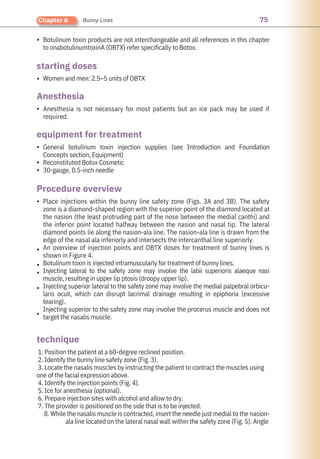 75
Chapter 6 Bunny Lines
•
•
•
•
•
•
•
•
•
•
•
•
Women and men: 2.5–5 units of OBTX
Anesthesia is not necessary for most patients but an ice pack may be used if
required.
Botulinum toxin products are not interchangeable and all references in this chapter
to onabotulinumtoxinA (OBTX) refer specifically to Botox.
1. Position the patient at a 60-degree reclined position.
2. Identify the bunny line safety zone (Fig. 3).
3. Locate the nasalis muscles by instructing the patient to contract the muscles using
one of the facial expression above.
4. Identify the injection points (Fig. 4).
5. Ice for anesthesia (optional).
6. Prepare injection sites with alcohol and allow to dry.
7. The provider is positioned on the side that is to be injected.
8. While the nasalis muscle is contracted, insert the needle just medial to the nasion-
ala line located on the lateral nasal wall within the safety zone (Fig. 5). Angle
General botulinum toxin injection supplies (see Introduction and Foundation
Concepts section, Equipment)
Reconstituted Botox Cosmetic
30-gauge, 0.5-inch needle
Place injections within the bunny line safety zone (Figs. 3A and 3B). The safety
zone is a diamond-shaped region with the superior point of the diamond located at
the nasion (the least protruding part of the nose between the medial canthi) and
the inferior point located halfway between the nasion and nasal tip. The lateral
diamond points lie along the nasion-ala line. The nasion-ala line is drawn from the
edge of the nasal ala inferiorly and intersects the intercanthal line superiorly.
An overview of injection points and OBTX doses for treatment of bunny lines is
shown in Figure 4.
Botulinum toxin is injected intramuscularly for treatment of bunny lines.
Injecting lateral to the safety zone may involve the labii superioris alaeque nasi
muscle, resulting in upper lip ptosis (droopy upper lip).
Injecting superior lateral to the safety zone may involve the medial palpebral orbicu-
laris oculi, which can disrupt lacrimal drainage resulting in epiphoria (excessive
tearing).
Injecting superior to the safety zone may involve the procerus muscle and does not
target the nasalis muscle.
technique
Anesthesia
starting doses
Procedure overview
equipment for treatment
 