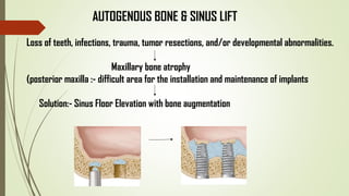 AUTOGENOUS BONE & SINUS LIFT
Loss of teeth, infections, trauma, tumor resections, and/or developmental abnormalities.
Maxillary bone atrophy
(posterior maxilla :- difficult area for the installation and maintenance of implants
Solution:- Sinus Floor Elevation with bone augmentation
 
