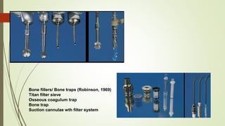 Bone fillers/ Bone traps (Robinson, 1969)
Titan filter sieve
Osseous coagulum trap
Bone trap
Suction cannulae wth filter system
 