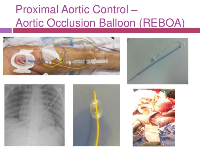 What Is A Reboa , REBOOT definition in American English – KVYOO