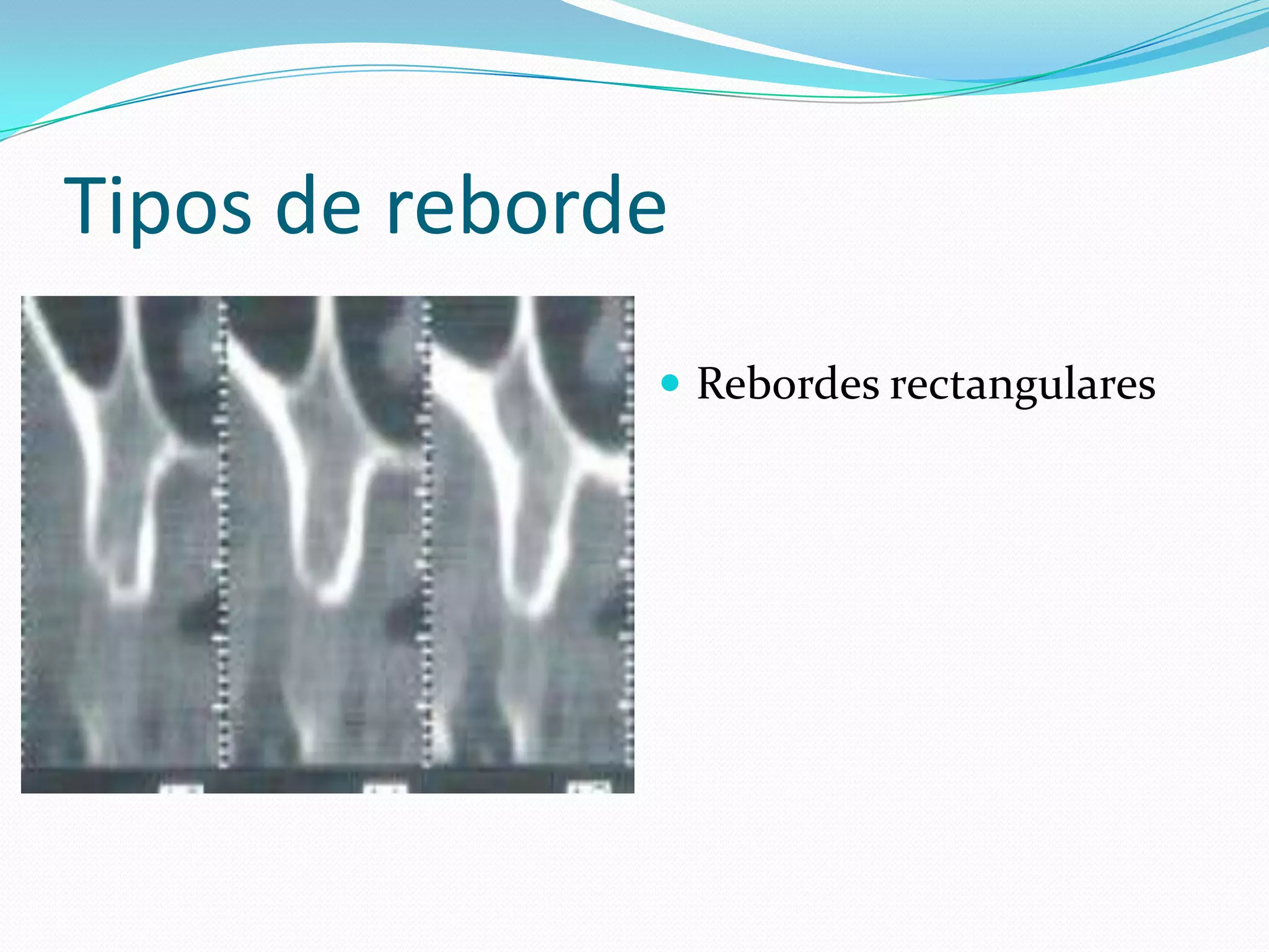 Rebordes residuales soporte tipos de fuerzas | PPT