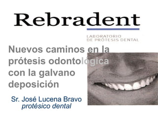 Nuevos caminos en la
prótesis odontológica
con la galvano
deposición
Sr. José Lucena Bravo
    protésico dental
 