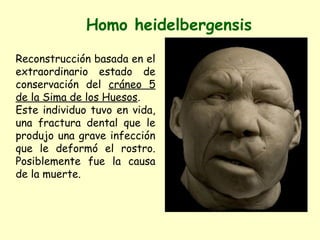 Homo heidelbergensis

Reconstrucción basada en el
extraordinario estado de
conservación del cráneo 5
de la Sima de los Huesos.
Este individuo tuvo en vida,
una fractura dental que le
produjo una grave infección
que le deformó el rostro.
Posiblemente fue la causa
de la muerte.
 