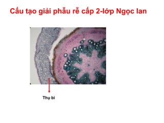 Cấu tạo giải phẫu rễ cấp 2-lớp Ngọc lan
Thụ bì
 