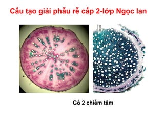 Cấu tạo giải phẫu rễ cấp 2-lớp Ngọc lan
Gỗ 2 chiếm tâm
 