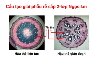 Cấu tạo giải phẫu rễ cấp 2-lớp Ngọc lan
Hậu thể gián đoạnHậu thể liên tục
Tia tủy
 