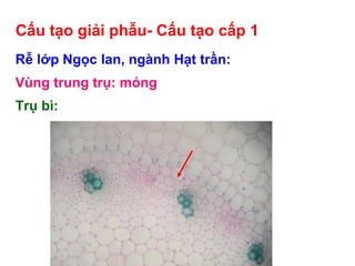 Cấu tạo giải phẫu- Cấu tạo cấp 1
Rễ lớp Ngọc lan, ngành Hạt trần:
Vùng trung trụ: mỏng
Trụ bì:
- 1-nhiều lớp tế bào xếp xen kẽ
- Vách – cellulose, sợi trụ bì
- Vùng hóa bần: rễ con mọc ra
 