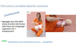 Stefania Bitti, Alberto Ferrando, Giancarlo Ottonello, Chiara Torrisi . www.apel-pediatri.it.
Ostruzione completa lattante cosciente
• Appoggia due dita della
mano al centro del torace
sulla linea che congiunge i
capezzoli e fai 5
compressioni
 