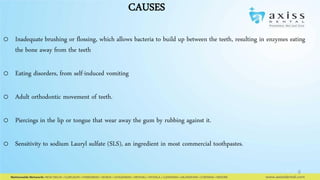 CAUSES
o Inadequate brushing or flossing, which allows bacteria to build up between the teeth, resulting in enzymes eating
the bone away from the teeth
o Eating disorders, from self-induced vomiting
o Adult orthodontic movement of teeth.
o Piercings in the lip or tongue that wear away the gum by rubbing against it.
o Sensitivity to sodium Lauryl sulfate (SLS), an ingredient in most commercial toothpastes.

6

 