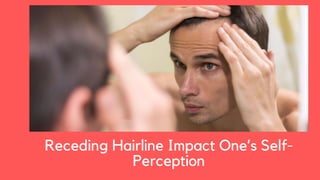 Receding Hairline Impact One’s Self-
Perception
 