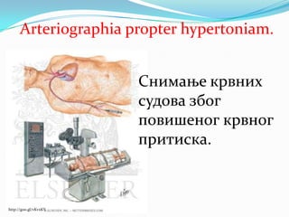 Arteriographia propter hypertoniam.
http://goo.gl/vKvxKY
Снимање крвних
судова због
повишеног крвног
притиска.
 