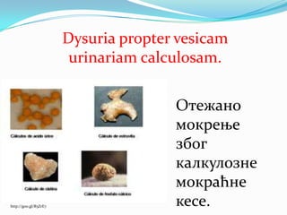 Отежано
мокрење
због
калкулозне
мокраћне
кесе.http://goo.gl/R5ZrE7
Dysuria propter vesicam
urinariam calculosam.
 