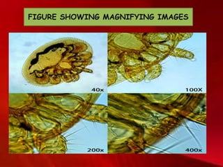 FIGURE SHOWING MAGNIFYING IMAGES
 