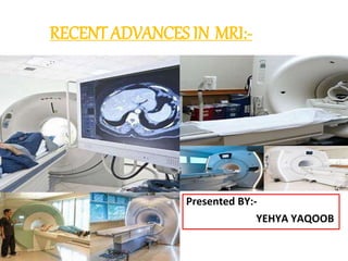 RECENT ADVANCES IN MRI:-
Presented BY:-
YEHYA YAQOOB
 
