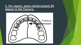 2. For repairs, place reinforcement 90
degree to the fracture.
 