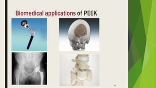 Recent advancements in denture base materials [autosaved]