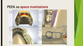 Recent advancements in denture base materials [autosaved]