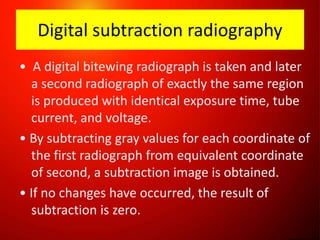 Substraction Radiograph Unit Recent advancements in paediatric dentistry | PPTX