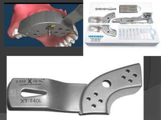 Recent advancements in procedures of atraumatic extraction of teeth | PPTX