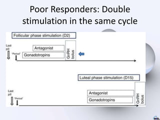 Poor Responders: Double
stimulation in the same cycle
 