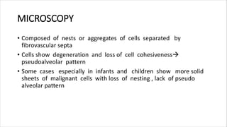 MICROSCOPY
• Composed of nests or aggregates of cells separated by
fibrovascular septa
• Cells show degeneration and loss of cell cohesiveness
pseudoalveolar pattern
• Some cases especially in infants and children show more solid
sheets of malignant cells with loss of nesting , lack of pseudo
alveolar pattern
 