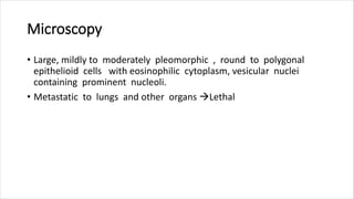 Microscopy
• Large, mildly to moderately pleomorphic , round to polygonal
epithelioid cells with eosinophilic cytoplasm, vesicular nuclei
containing prominent nucleoli.
• Metastatic to lungs and other organs Lethal
 
