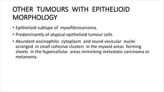 OTHER TUMOURS WITH EPITHELIOID
MORPHOLOGY
• Epithelioid subtype of myxofibrosarcoma.
• Predominantly of atypical epithelioid tumour cells
• Abundant eosinophilic cytoplasm and round vesicular nuclei
arranged in small cohesive clusters in the myxoid areas forming
sheets in the hypercellular areas mimicking metastatic carcinoma or
melanoma.
 