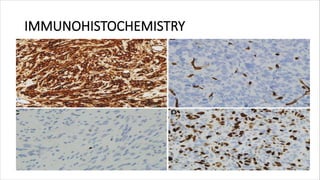 IMMUNOHISTOCHEMISTRY
 