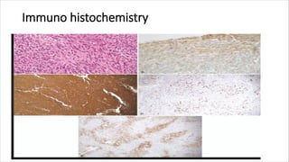 Immuno histochemistry
 