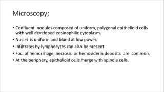 Microscopy;
• Confluent nodules composed of uniform, polygonal epithelioid cells
with well developed eosinophilic cytoplasm.
• Nuclei is uniform and bland at low power.
• Infiltrates by lymphocytes can also be present.
• Foci of hemorrhage, necrosis or hemosiderin deposits are common.
• At the periphery, epithelioid cells merge with spindle cells.
 