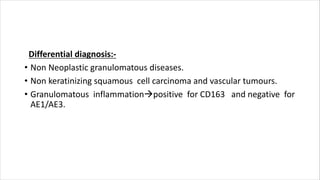 Differential diagnosis:-
• Non Neoplastic granulomatous diseases.
• Non keratinizing squamous cell carcinoma and vascular tumours.
• Granulomatous inflammationpositive for CD163 and negative for
AE1/AE3.
 