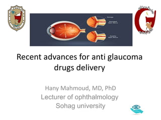 Recent advances for anti glaucoma
drugs delivery
Hany Mahmoud, MD, PhD
Lecturer of ophthalmology
Sohag university
 