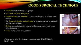 GOOD SURGICAL TECHNIQUE
• Minimal use of dry towels or sponges..
• Use starch and latex-free gloves.
• Reduce pressure and duration of pneumoperitoneum in laparoscopic
surgery.
• Use frequent irrigation and aspiration in laparoscopic and laparotomic
surgery when needed.
• Reduce cautery time and frequency and aspirate aerosolized tissue
following cautery.
• Excise tissue—reduce fulguration.
Consensus In Adhesion Reduction management, TOG 2004:6(2),
RCOG Press
 