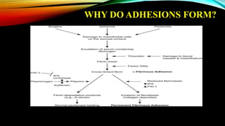 WHY DO ADHESIONS FORM?
 