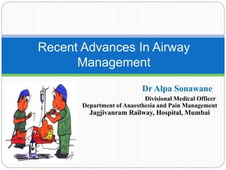 Dr Alpa Sonawane
Divisional Medical Officer
Department of Anaesthesia and Pain Management
Jagjivanram Railway, Hospital, Mumbai
Recent Advances In Airway
Management
 