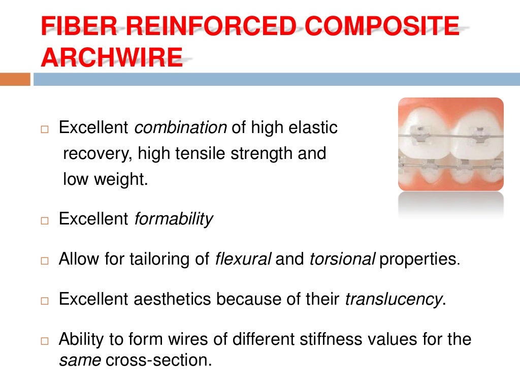 Recent advances in arch wires
