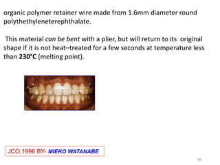 88
JCO,1996 BY- MIEKO WATANABE
organic polymer retainer wire made from 1.6mm diameter round
polythethyleneterephthalate.
This material can be bent with a plier, but will return to its original
shape if it is not heat–treated for a few seconds at temperature less
than 230°C (melting point).
 