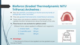 Recent Advances in Archwires [Autosaved].pptx